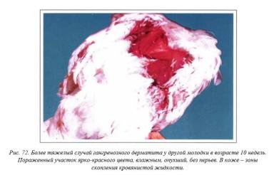 Вегад - Атлас болезней птицы. Ч. 10. Гангренозный дерматит