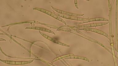 Фузариоз колоса Fusarium graminearum