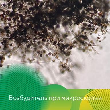 Контроль альтернариоза картофеля