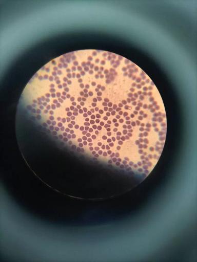 Вопросы из чатов: это пироплазмоз?