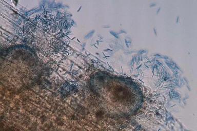 Септориоз колоса