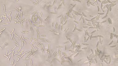 Фузариоз колоса Fusarium culmorum