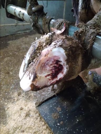 Болезнь белой линии (травма белой линии)