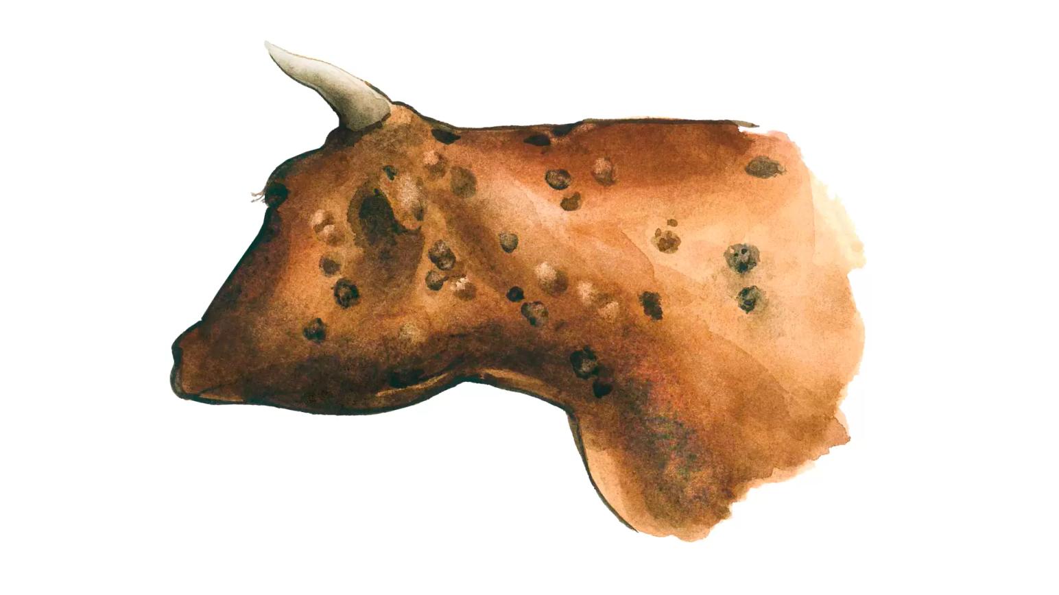 Сибирская язва