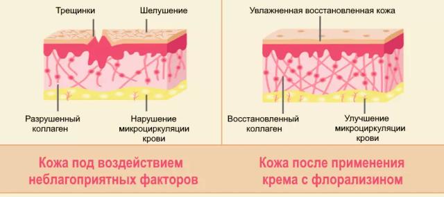 Влияние крема Зорька с флорализином на кожу
