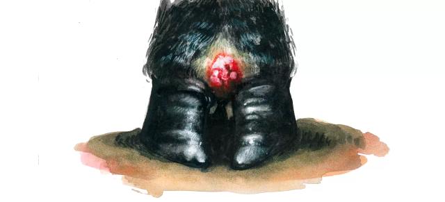 Инфекционный пододерматит КРС 