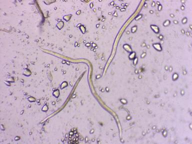 Стеблевая нематода и Луна® Транквилити