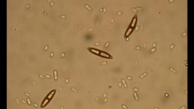 Гибеллиноз пшеницы