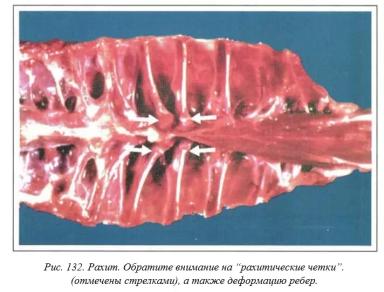 Вегад - Атлас болезней птицы. Ч. 26. Рахит