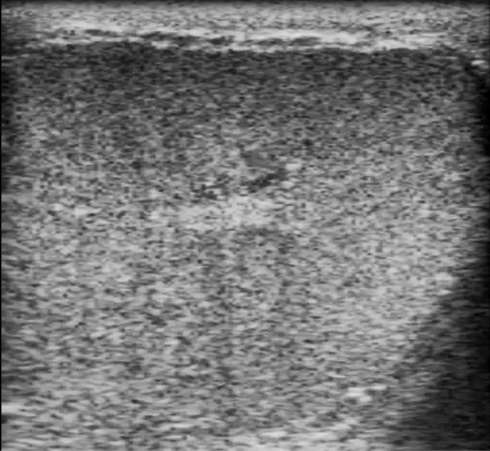 Интерактив по УЗИ!)