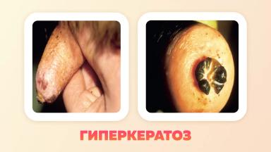 Неинфекционные заболевания вымени коров