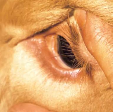 Бабезиоз КРС