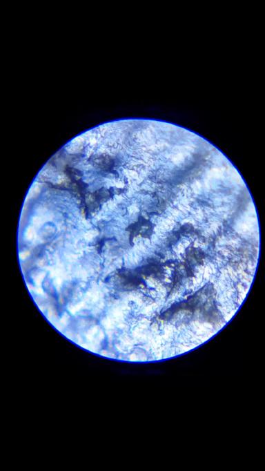 Кровоизлияние в подошве копытца у коровы