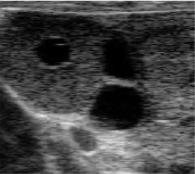 Кисты яичника у КРС