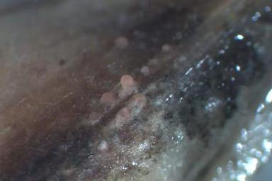 Септориоз колоса