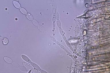 Мучнистая роса