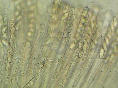 Склеротиниоз (белая гниль) подсолнечника