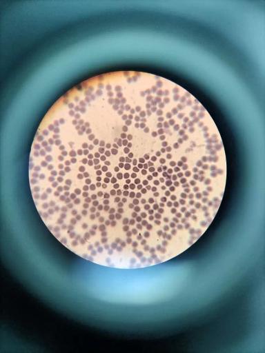 Вопросы из чатов: это пироплазмоз?