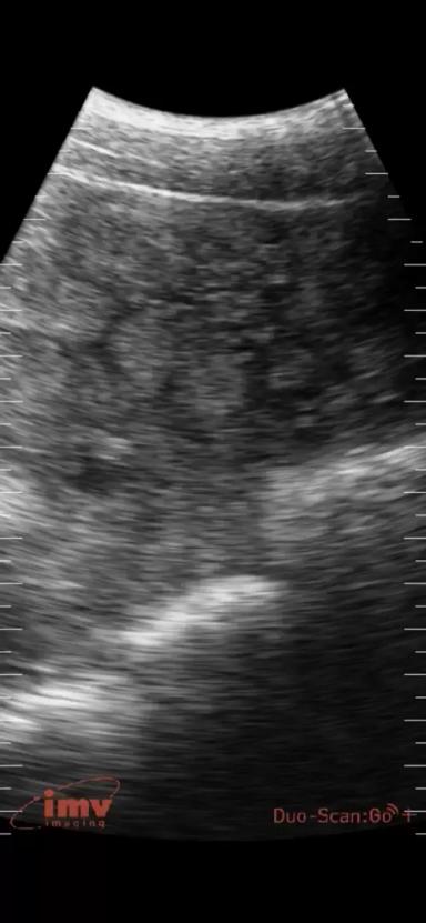 Определение супоросности на ранних сроках при помощи УЗИ!