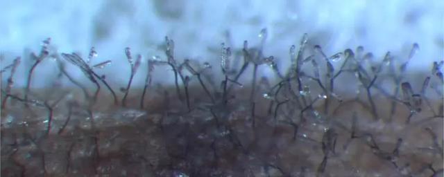 Сетчатая пятнистость ячменя