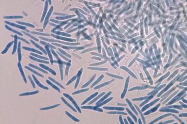 Септориоз колоса