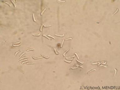 Ринхоспориоз (окаймленная пятнистость)