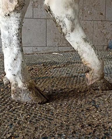 Паралич запирательного и седалищного нервов