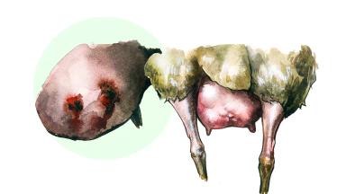 Актиномикоз