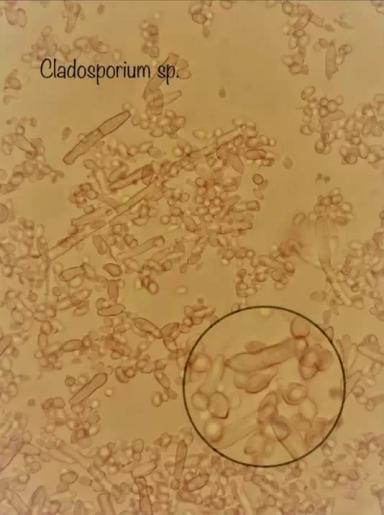 Чернь колоса