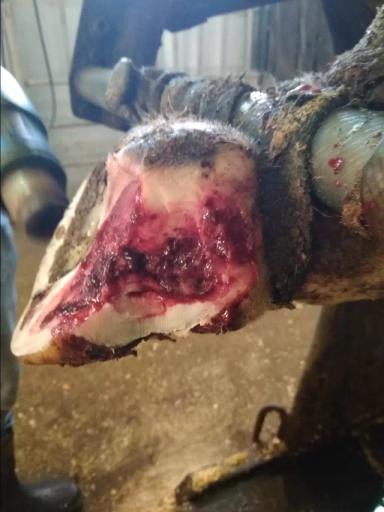 Болезнь белой линии (травма белой линии)