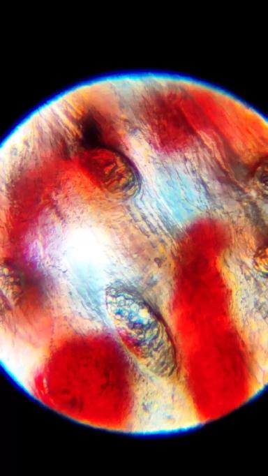 Кровоизлияние в подошве копытца у коровы