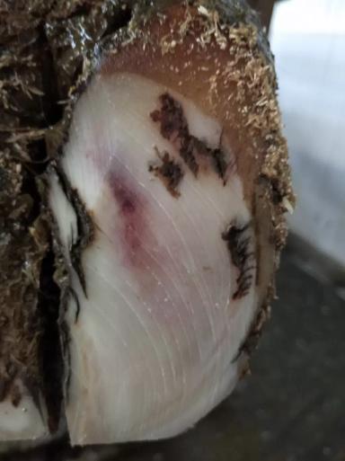 Подошвенные кровоизлияния