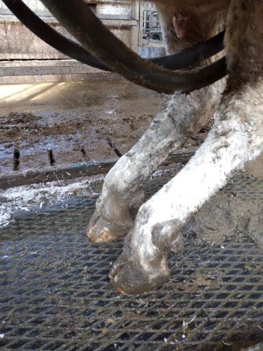 Паралич запирательного и седалищного нервов