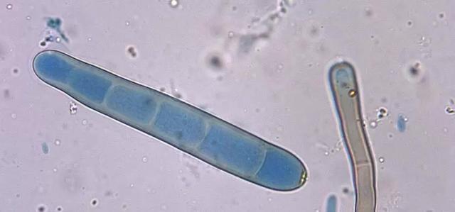 Сетчатая пятнистость ячменя