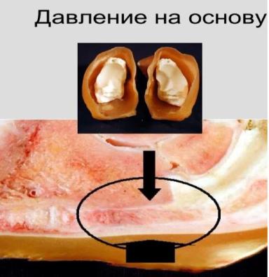 Кровоизлияние в подошве копытца у коровы