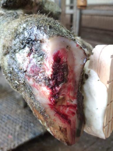 Болезнь белой линии (травма белой линии)