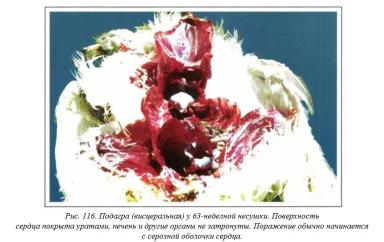 Вегад - Атлас болезней птицы. Ч. 23. Подагра