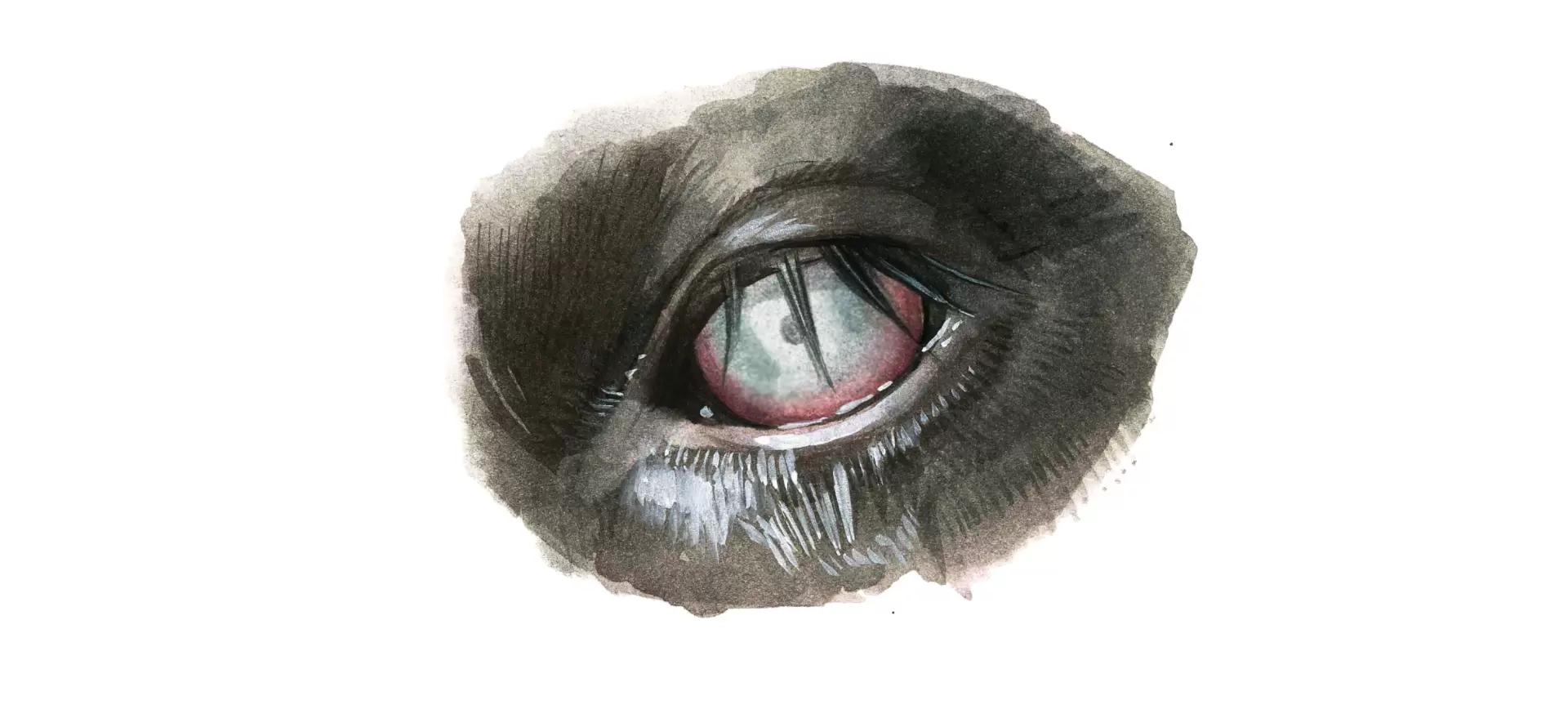 Инфекционный кератоконъюнктивит КРС