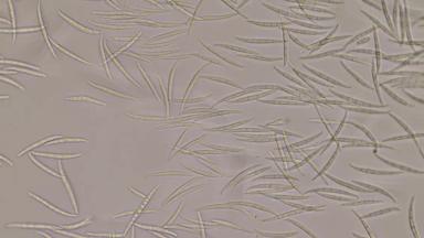 Фузариоз колоса Fusarium avenaceum