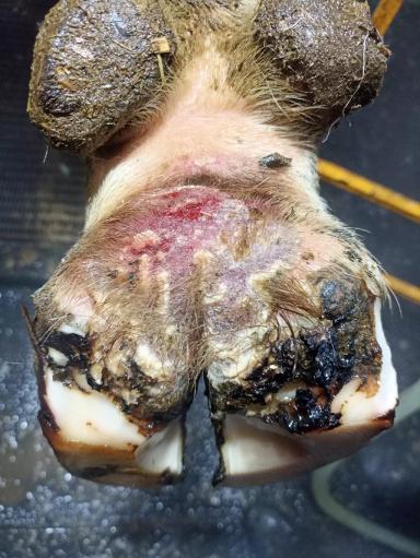 Пальцевый дерматит