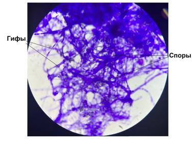 ФИТОСПОРИН АС, Ж – НОВЫЙ УРОВЕНЬ БИОЗАЩИТЫ!