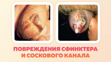 Неинфекционные заболевания вымени коров