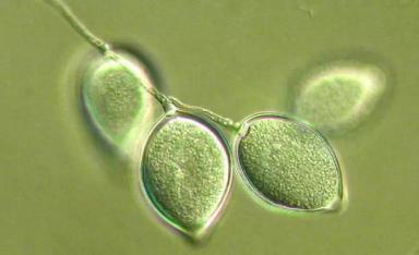 Фитофтороз картофеля