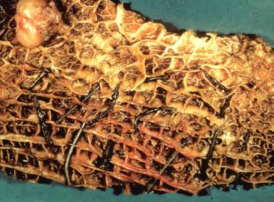 Травматический ретикулоперитонит и ретикулоперикардит у КРС