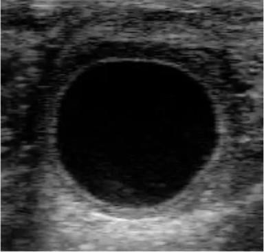 Кисты яичника у КРС