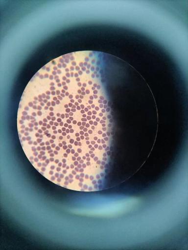 Вопросы из чатов: это пироплазмоз?