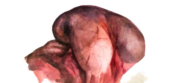 Воспаление и язвы сычуга