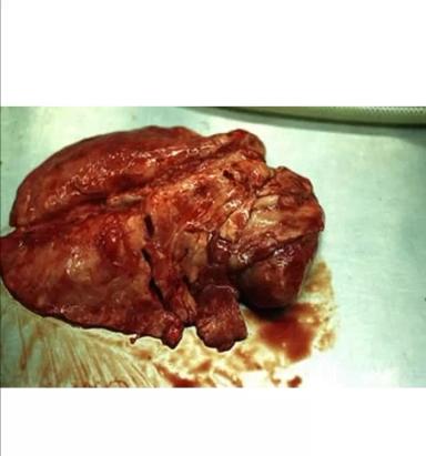 Актинобацеллезная плевропневмония свиней (АПП)