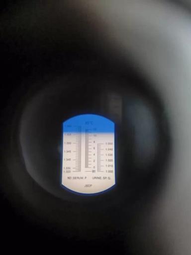 Вопросы из чатов: оптимален ли уровень иммуноглобулинов?