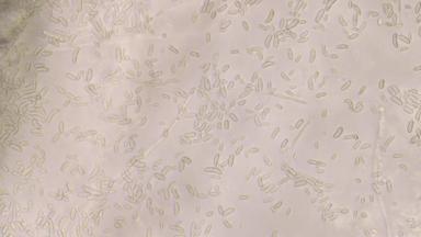 Фузариоз колоса Fusarium sporotrichioides